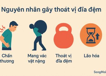 Nguyên nhân thoát vị đĩa đệm