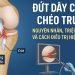 Đứt dây chằng chéo trước: Nguyên nhân, triệu chứng và cách điều trị hiệu quả.
