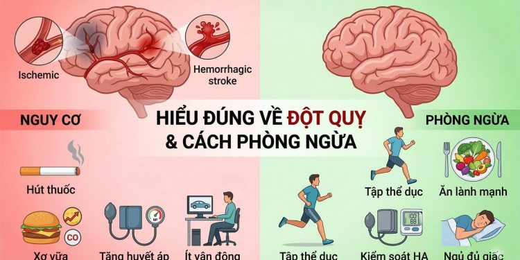 Đột Quỵ: ‘Kẻ Sát Nhân Thầm Lặng’ Và 5 Dấu Hiệu Cảnh Báo Bạn Không Được Phớt Lờ