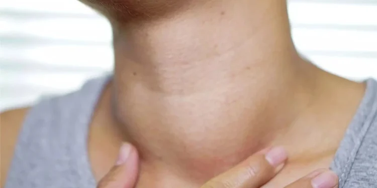 Ung Thư Tuyến Giáp: Nhận Diện Sớm Dấu Hiệu Để Điều Trị Hiệu Quả