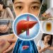 7 dấu hiệu thường gặp ở người mắc bệnh gan – Cảnh báo sớm không nên bỏ qua