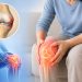Đau Gối, Cứng Khớp Có Thể Là Dấu Hiệu Thoái Hóa Khớp Gối: Đừng Chủ Quan